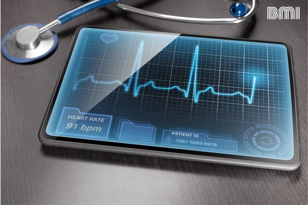 Electrocardiograma